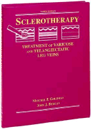 Sclerotherapy: Treatment of Varicose and Telangiectatic Leg Veins
