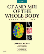 CT and MRI of the Whole Body, 2-Volume Set