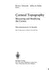 Corneal Topography: Measuring and Modifying the Cornea