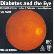 Diabetes and the Eye (CD-ROM)