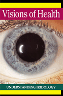 Visions of Health: Understanding Iridology