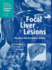 Focal Liver Lesions