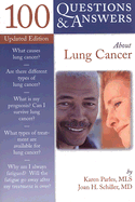 100 Questions & Answers about Lung Cancer