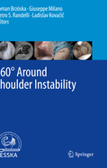 360? Around Shoulder Instability