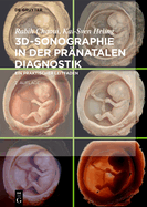 3d-Sonographie in Der Prnatalen Diagnostik: Ein Praktischer Leitfaden