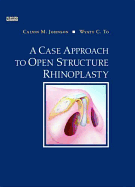 A Case Approach to Open Structure Rhinoplasty - Johnson, Calvin M, MD, and To, Wyatt C, MD