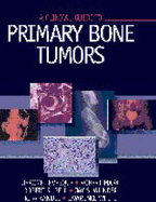 A Clinical Guide to Primary Bone Tumors