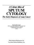 A colour atlas of sputum cytology.