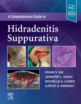 A Comprehensive Guide to Hidradenitis Suppurativa - Shi, Vivian Y, MD, and Hsiao, Jennifer L, MD, and Lowes, Michelle A, MD, PhD