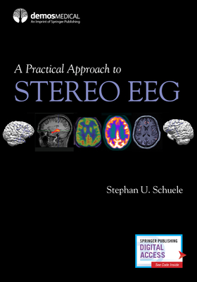 A Practical Approach to Stereo Eeg - Schuele, Stephan, MD, MPH (Editor)