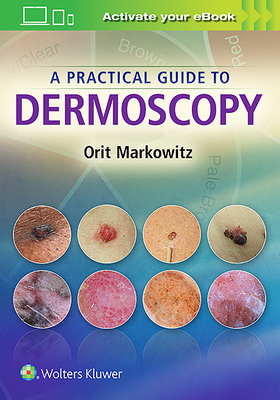 A Practical Guide to Dermoscopy - Markowitz, Orit