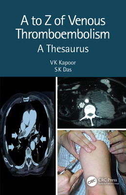 A to Z of Venous Thromboembolism: A Thesaurus - Kapoor, Vk, and Das, Sk