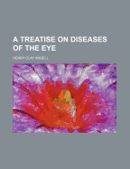 A Treatise on Diseases of the Eye