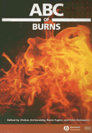 ABC of Burns