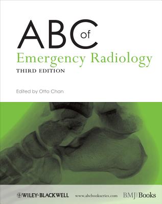 ABC of Emergency Radiology - Chan, Otto (Editor)