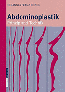 Abdominoplastik: Prinzip Und Technik