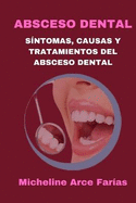Absceso Dental: Sntomas, Causas Y Tratamientos del Absceso Dental