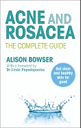 Acne and Rosacea: The Complete Guide