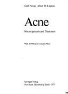 Acne: Morphogenesis and Treatment