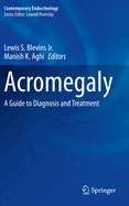 Acromegaly: A Guide to Diagnosis and Treatment