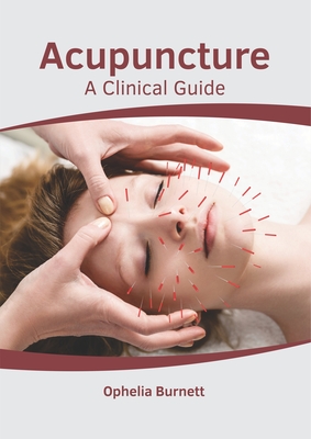 Acupuncture: A Clinical Guide - Burnett, Ophelia (Editor)