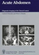 Acute Abdomen: Diagnostic Imaging in the Clinical Context