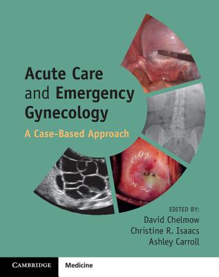 Acute Care and Emergency Gynecology: A Case-Based Approach - Chelmow, David (Editor), and Isaacs, Christine R (Editor), and Carroll, Ashley (Editor)