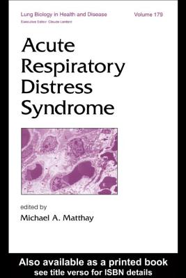 Acute Respiratory Distress Syndrome - Matthay, Michael A (Editor)