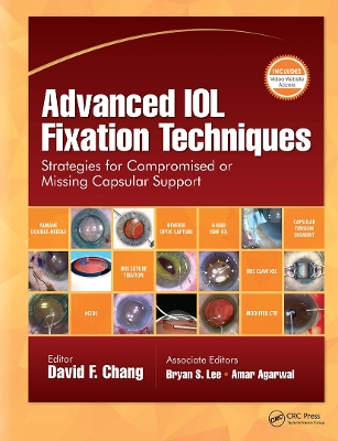 Advanced IOL Fixation Techniques: Strategies for Compromised or Missing Capsular Support - Chang, David F, MD