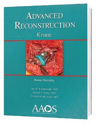 Advanced Reconstruction: Knee - Lieberman, Jay R., and Berry, Daniel J., and Azar, Frederick M., MD