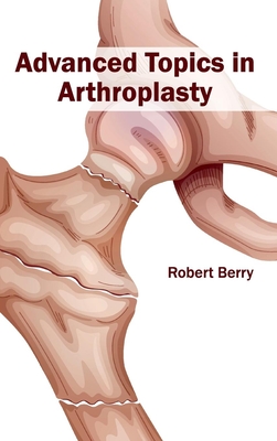 Advanced Topics in Arthroplasty - Berry, Robert (Editor)