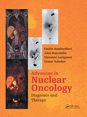 Advances in Nuclear Oncology:: Diagnosis and Therapy - Bombardieri, Emilio (Editor), and Buscombe, John (Editor), and Lucignani, Giovanni (Editor)