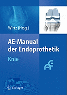 Ae-Manual Der Endoprothetik: Knie