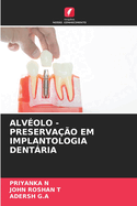 Alv?olo - Preserva??o Em Implantologia Dentria