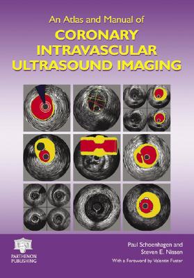 An Atlas and Manual of Coronary Intravascular Ultrasound Imaging - Schoenhagen, Paul, M.D. (Editor), and Nissen, Steven E (Editor)