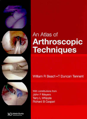 An Atlas of Arthroscopic Techniques - Beach, William R, and Tennent, T Duncan, and Caspari, Richard B, MD