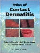 An Atlas of Contact Dermatitis