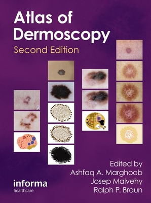 An Atlas of Dermoscopy - Marghoob, Ashfaq (Editor), and Braun, Ralph (Editor)