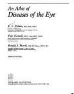 An atlas of diseases of the eye