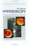 An Atlas of Hysteroscopy - Guedj, H, and Valle, R F