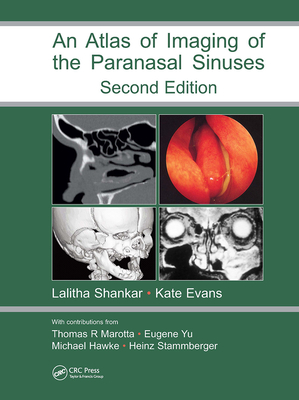 An Atlas of Imaging of the Paranasal Sinuses - Shankar, Lalitha (Editor), and Evans, Kathryn (Editor)