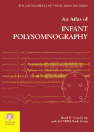 An Atlas of Infant Polysomnography