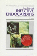 An Atlas of Infective Endocarditis: Diagnosis and Management - Ward, C