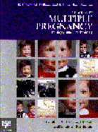 An Atlas of Multiple Pregnancy: Biology and Pathology - Machin, G a, and Keith, Louis G, M.D.