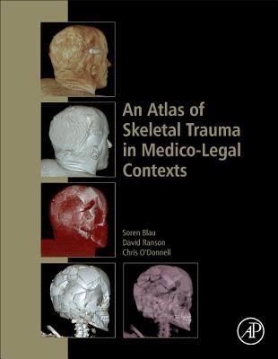 An Atlas of Skeletal Trauma in Medico-Legal Contexts - Blau, Soren, and Ranson, David L., and O'Donnell, Chris