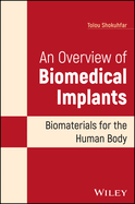 An Overview of Biomedical Implants: Biomaterials for the Human Body