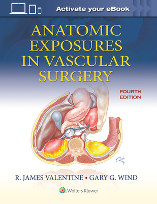 Anatomic Exposures in Vascular Surgery - Valentine, R James, MD, Facs, and Wind, Gary G, MD