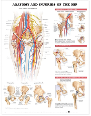Anatomy and Injuries of the Hip Anatomical Chart - Acc, and Anatomical Chart Company (Editor)