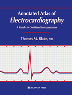 Annotated Atlas of Electrocardiography: A Guide to Confident Interpretation
