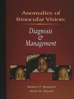 Anomalies of Binocular Vision: Diagnosis and Management - Rutstein, Robert P, and Daum, Kent M, Od, MS, PhD